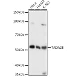 Western Blot - Anti-TADA2B Antibody (A92014) - Antibodies.com