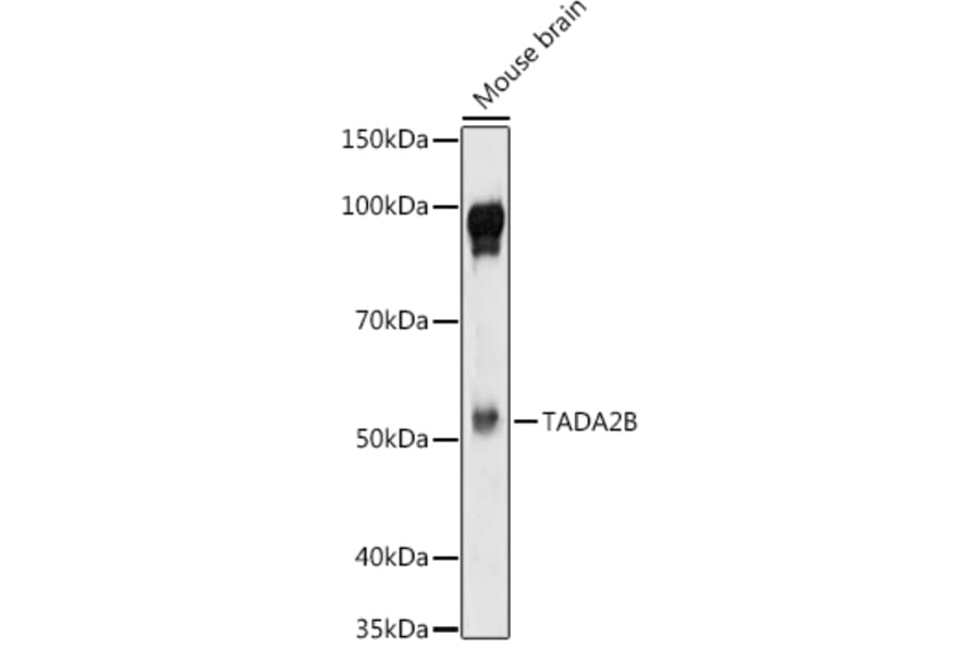 Western Blot - Anti-TADA2B Antibody (A92014) - Antibodies.com