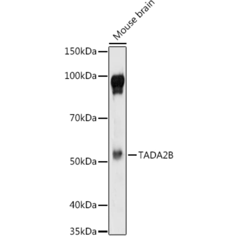 Western Blot - Anti-TADA2B Antibody (A92014) - Antibodies.com