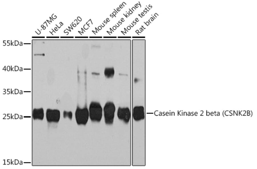 Western Blot - Anti-Casein Kinase 2 beta Antibody (A92015) - Antibodies.com