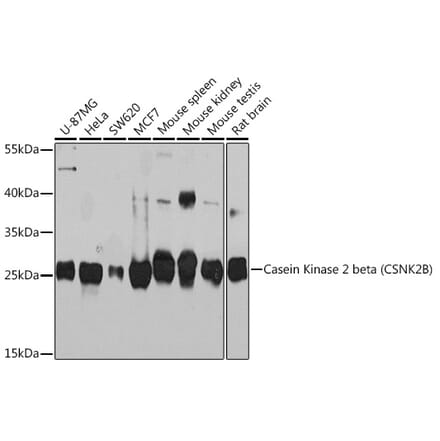 Western Blot - Anti-Casein Kinase 2 beta Antibody (A92015) - Antibodies.com