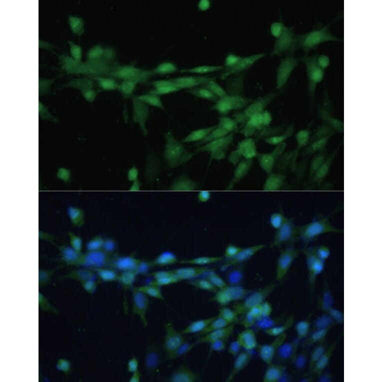 Immunofluorescence - Anti-Casein Kinase 2 beta Antibody (A92015) - Antibodies.com