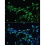 Immunofluorescence - Anti-Casein Kinase 2 beta Antibody (A92015) - Antibodies.com