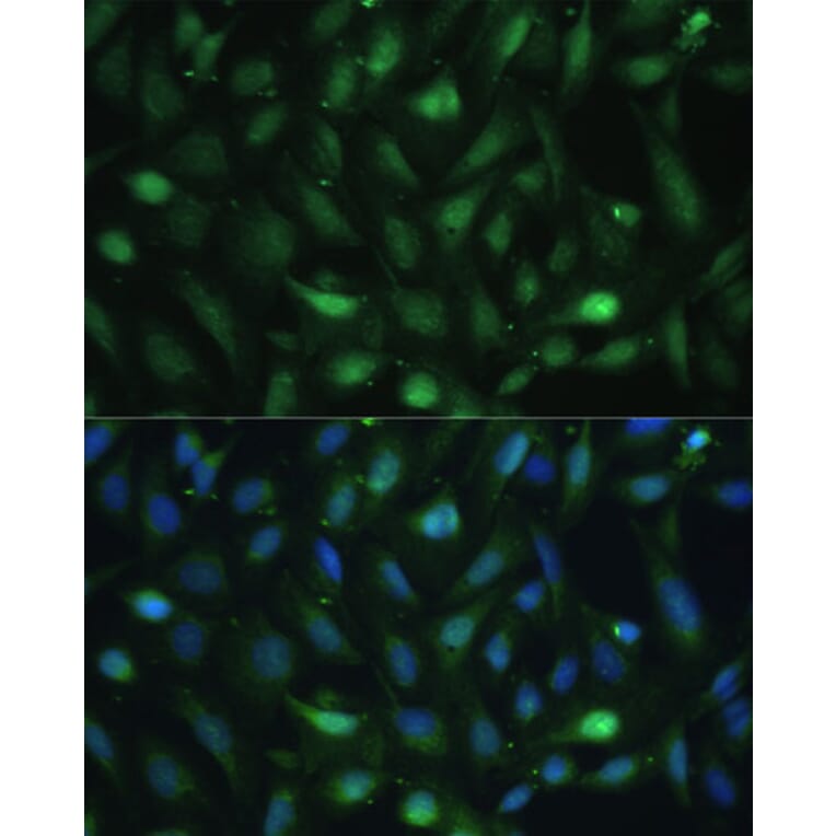Immunofluorescence - Anti-Casein Kinase 2 beta Antibody (A92015) - Antibodies.com