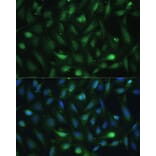 Immunofluorescence - Anti-Casein Kinase 2 beta Antibody (A92015) - Antibodies.com
