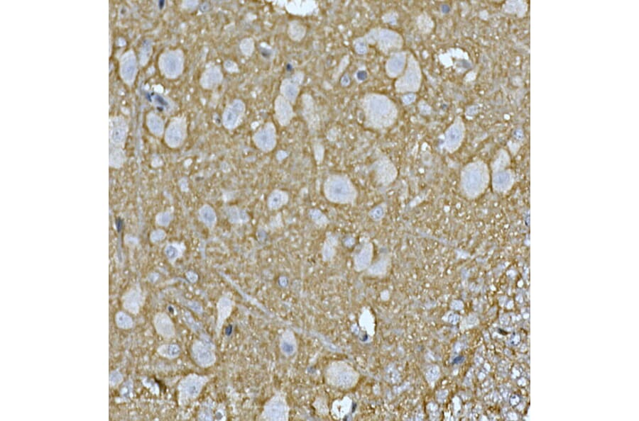 Immunohistochemistry - Anti-Rab4 Antibody (A92016) - Antibodies.com