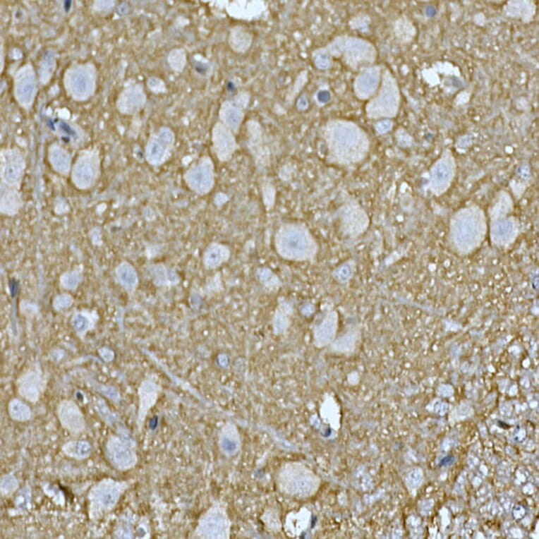Immunohistochemistry - Anti-Rab4 Antibody (A92016) - Antibodies.com