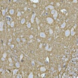 Immunohistochemistry - Anti-Rab4 Antibody (A92016) - Antibodies.com