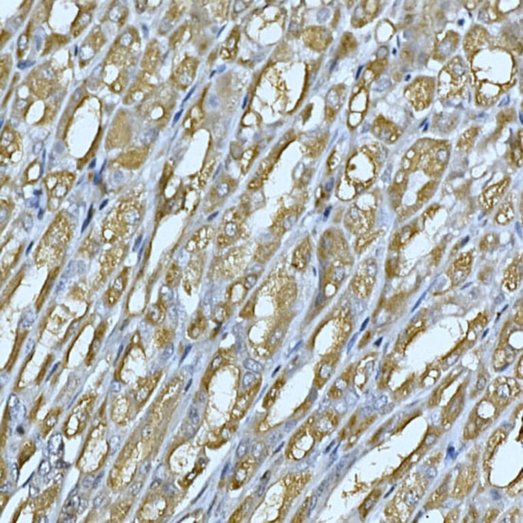 Immunohistochemistry - Anti-Rab4 Antibody (A92016) - Antibodies.com