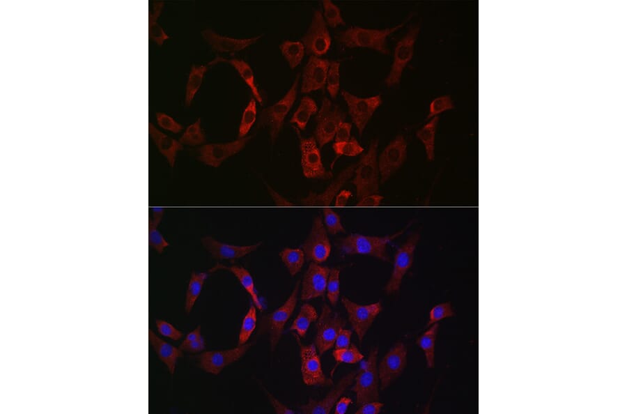 Immunofluorescence - Anti-Rab4 Antibody (A92016) - Antibodies.com
