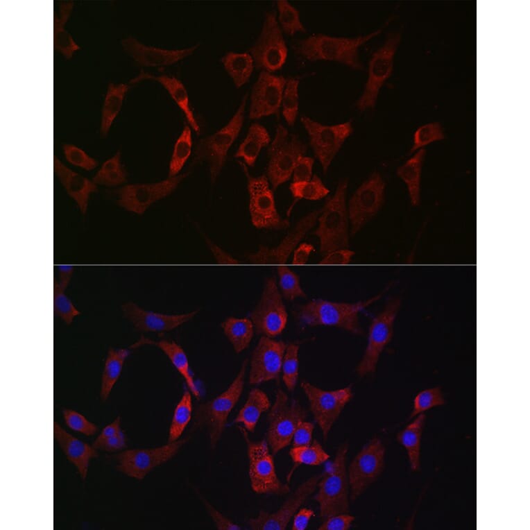Immunofluorescence - Anti-Rab4 Antibody (A92016) - Antibodies.com