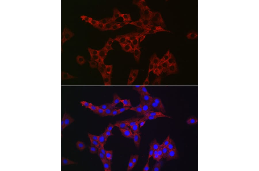 Immunofluorescence - Anti-Rab4 Antibody (A92016) - Antibodies.com