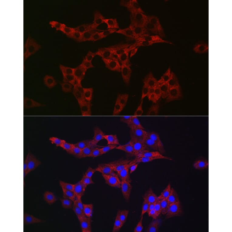 Immunofluorescence - Anti-Rab4 Antibody (A92016) - Antibodies.com