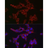 Immunofluorescence - Anti-Rab4 Antibody (A92016) - Antibodies.com