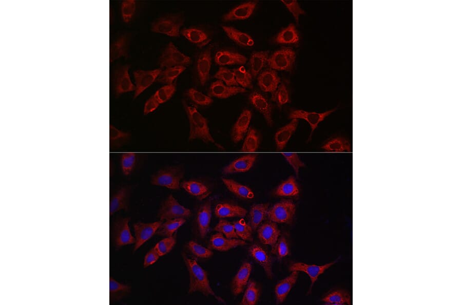 Immunofluorescence - Anti-Rab4 Antibody (A92016) - Antibodies.com