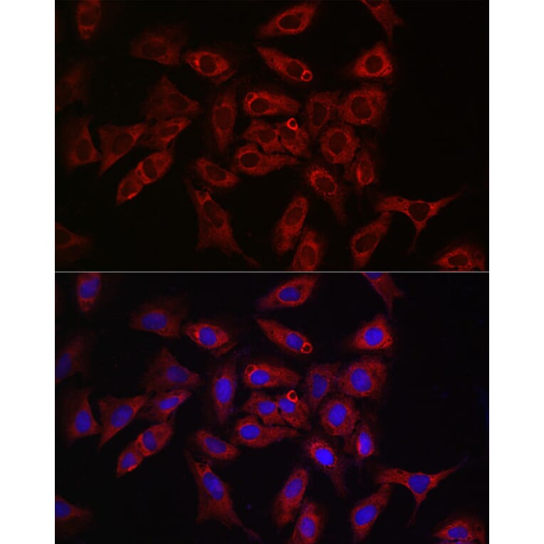 Immunofluorescence - Anti-Rab4 Antibody (A92016) - Antibodies.com