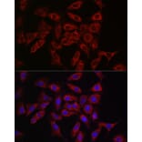 Immunofluorescence - Anti-Rab4 Antibody (A92016) - Antibodies.com