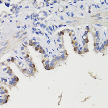 Immunohistochemistry of paraffin-embedded rat bronchus using Anti-DEPDC6 Antibody (A17305) at dilution of 1:200 (40x lens).