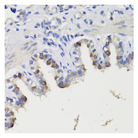 Immunohistochemistry - Anti-Deptor Antibody (A92017) - Antibodies.com