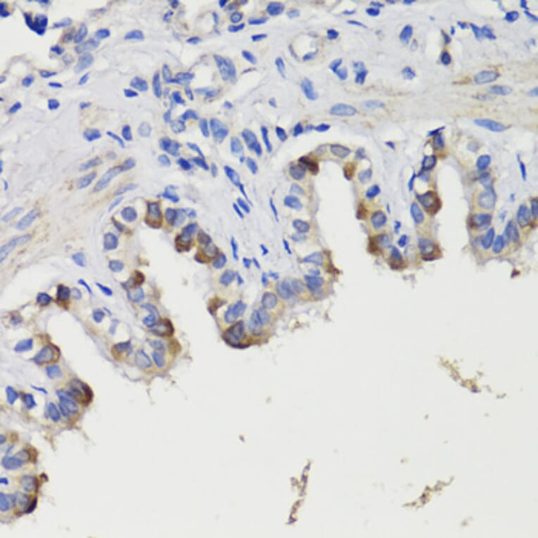 Immunohistochemistry - Anti-Deptor Antibody (A92017) - Antibodies.com