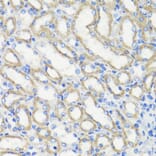 Immunohistochemistry - Anti-Deptor Antibody (A92017) - Antibodies.com