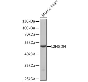 Western Blot - Anti-L2HGDH Antibody (A92018) - Antibodies.com