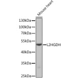 Western Blot - Anti-L2HGDH Antibody (A92018) - Antibodies.com