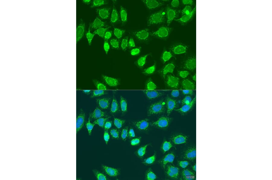 Immunofluorescence - Anti-L2HGDH Antibody (A92018) - Antibodies.com