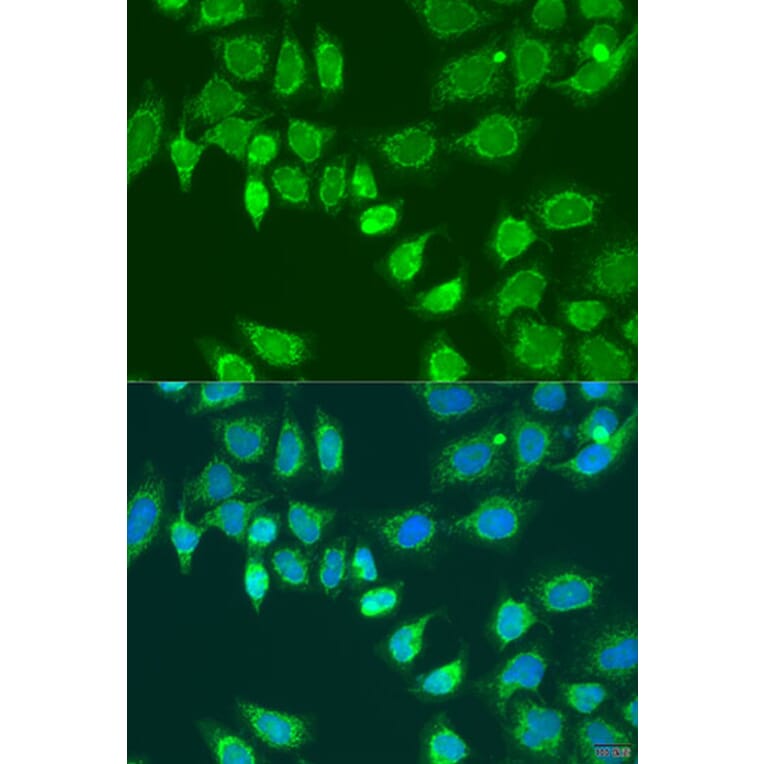 Immunofluorescence - Anti-L2HGDH Antibody (A92018) - Antibodies.com