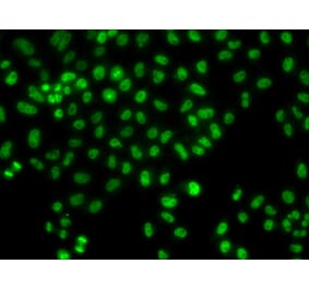 Immunofluorescence - Anti-LHX8 Antibody (A92019) - Antibodies.com