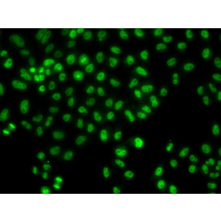 Immunofluorescence - Anti-LHX8 Antibody (A92019) - Antibodies.com