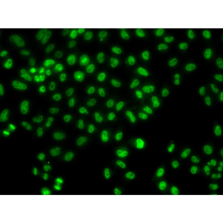 Immunofluorescence - Anti-LHX8 Antibody (A92019) - Antibodies.com