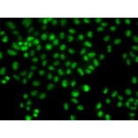 Immunofluorescence - Anti-LHX8 Antibody (A92019) - Antibodies.com