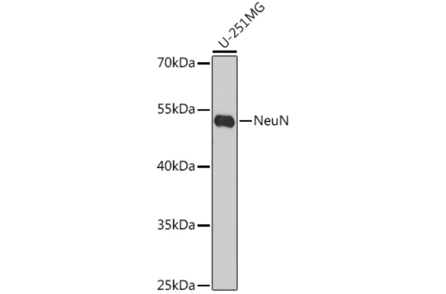 Western Blot - Anti-NeuN Antibody (A92020) - Antibodies.com