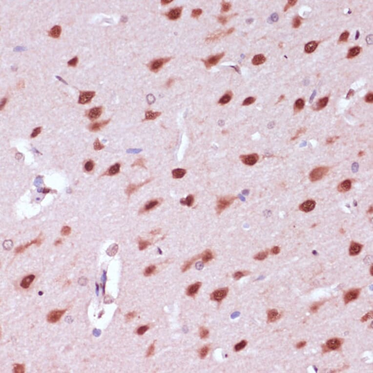 Immunohistochemistry - Anti-NeuN Antibody (A92020) - Antibodies.com