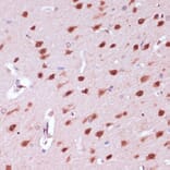 Immunohistochemistry - Anti-NeuN Antibody (A92020) - Antibodies.com
