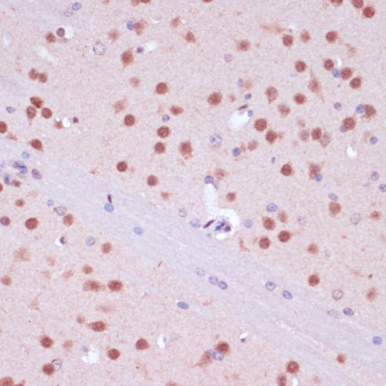 Immunohistochemistry - Anti-NeuN Antibody (A92020) - Antibodies.com