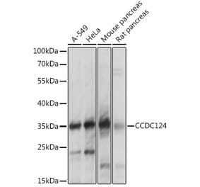 Western Blot - Anti-CCDC124 Antibody (A92024) - Antibodies.com