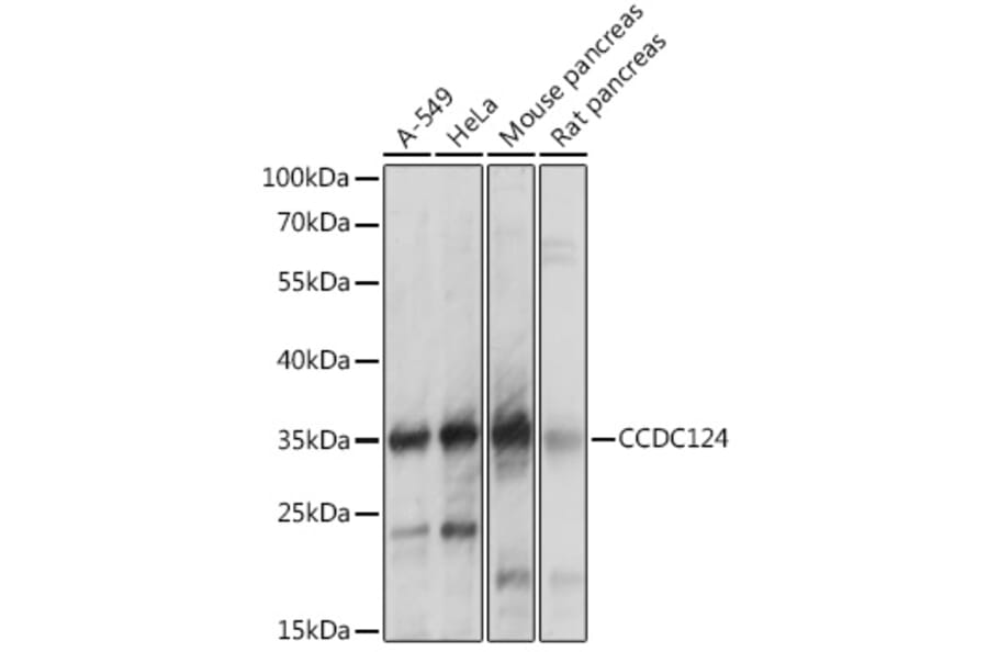 Western Blot - Anti-CCDC124 Antibody (A92024) - Antibodies.com