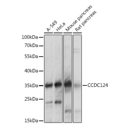 Western Blot - Anti-CCDC124 Antibody (A92024) - Antibodies.com