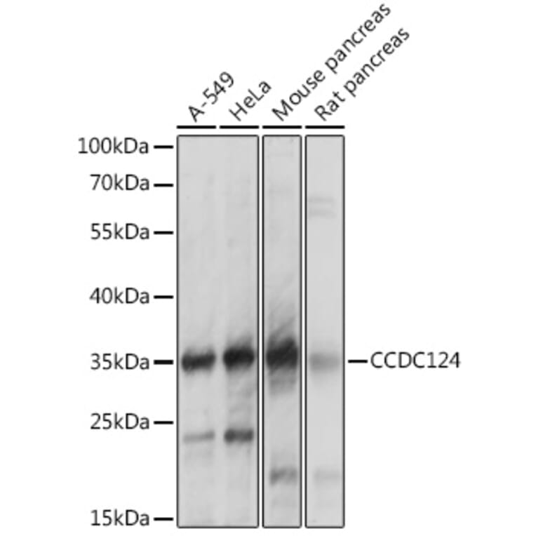 Western Blot - Anti-CCDC124 Antibody (A92024) - Antibodies.com