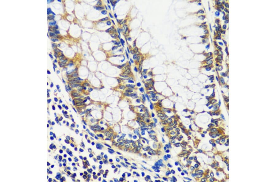 Immunohistochemistry - Anti-CCDC124 Antibody (A92024) - Antibodies.com