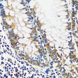 Immunohistochemistry - Anti-CCDC124 Antibody (A92024) - Antibodies.com