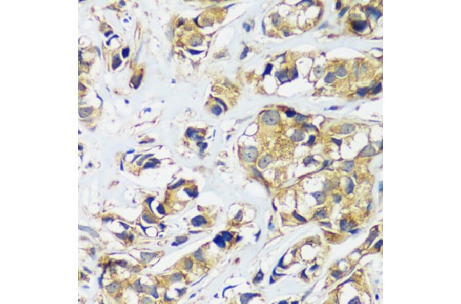 Immunohistochemistry - Anti-CCDC124 Antibody (A92024) - Antibodies.com