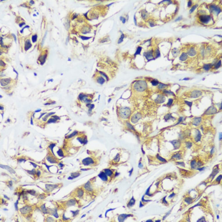 Immunohistochemistry - Anti-CCDC124 Antibody (A92024) - Antibodies.com