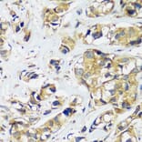 Immunohistochemistry - Anti-CCDC124 Antibody (A92024) - Antibodies.com