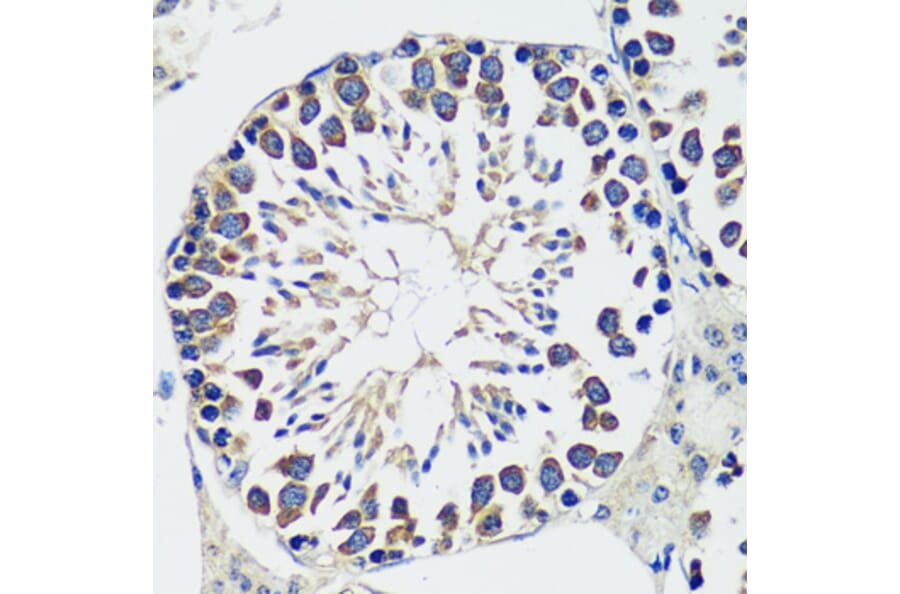 Immunohistochemistry - Anti-CCDC124 Antibody (A92024) - Antibodies.com