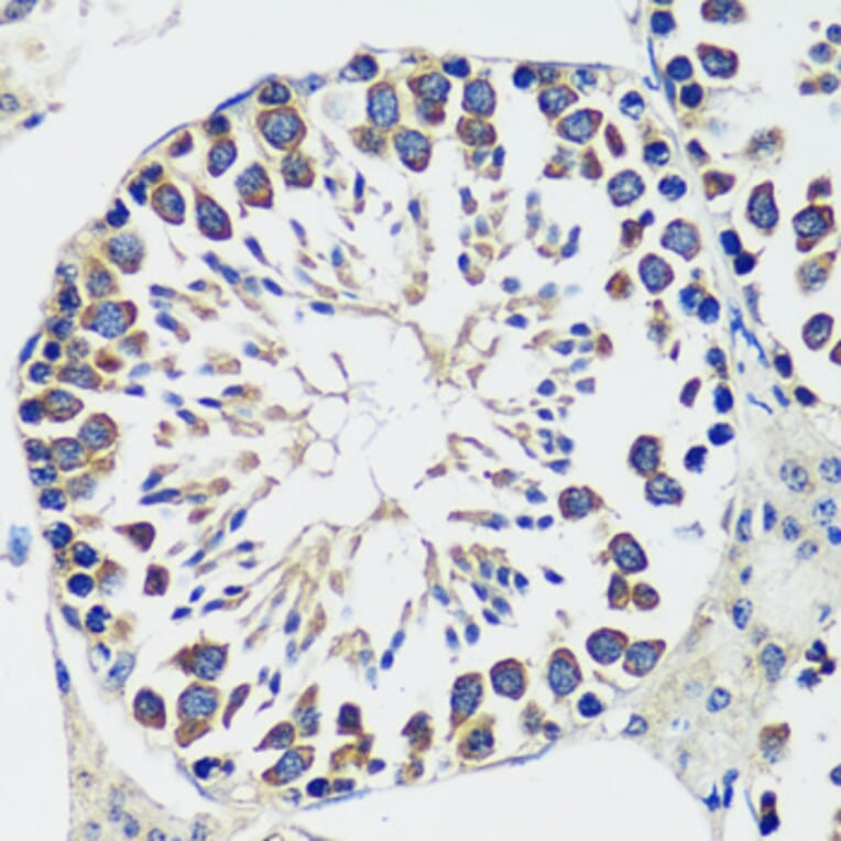 Immunohistochemistry - Anti-CCDC124 Antibody (A92024) - Antibodies.com