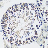 Immunohistochemistry - Anti-CCDC124 Antibody (A92024) - Antibodies.com