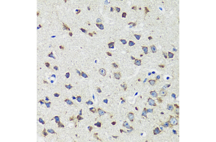 Immunohistochemistry - Anti-CCDC124 Antibody (A92024) - Antibodies.com
